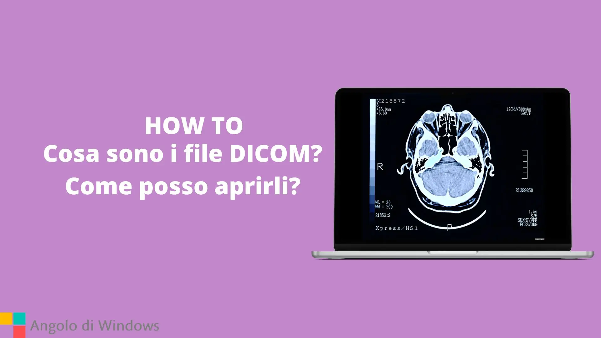 Cosa sono i file DICOM? Come posso aprirli?